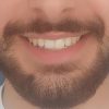 smile-36 smile-36